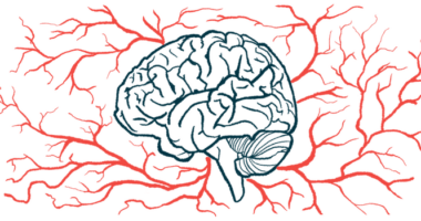 A brain is surrounded by a network of blood vessels in this illustration.