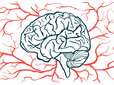 A brain is surrounded by a network of blood vessels in this illustration.