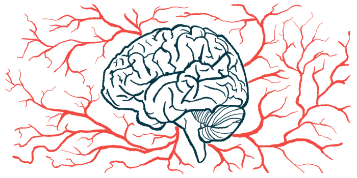 A brain is surrounded by a network of blood vessels in this illustration.